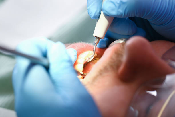 Best Weekend Emergency Dentist in Dewitt, AR