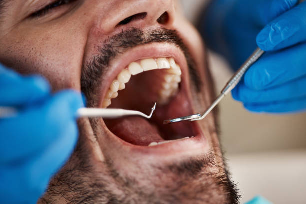 Best Emergency Dental Care for Broken or Chipped Teeth in Dewitt, AR